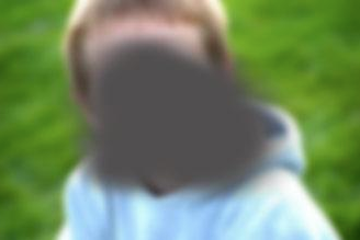 Picture_Macular degeneration_Macular factor_Macular degeneration