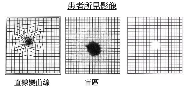 圖片_黃斑點病_所見影像_測試