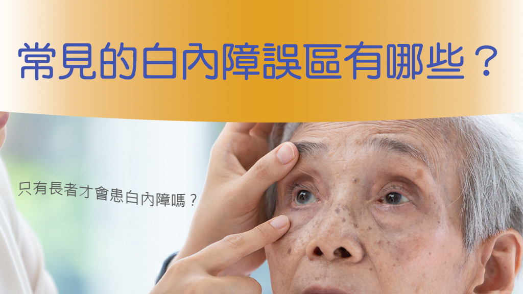 Cover image_Cataract_Common myths