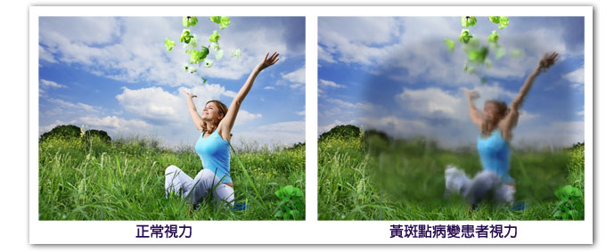 圖片_黃斑點視力