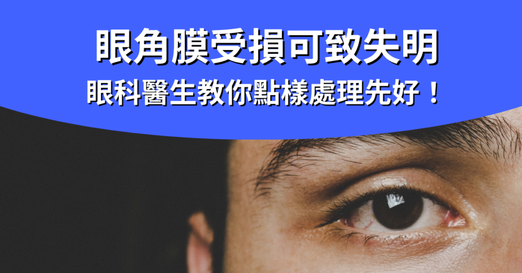 眼角膜受損_封面圖