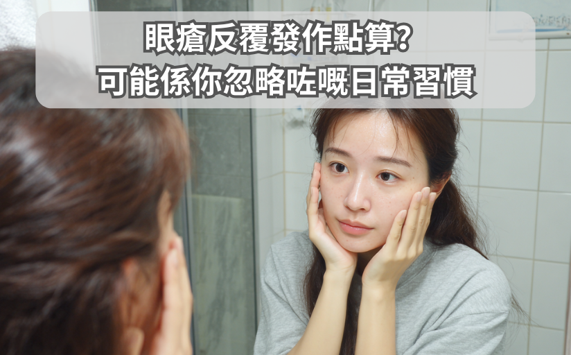 眼瘡反覆發作點算？醫生話你知：可能係你忽略咗嘅日常習慣